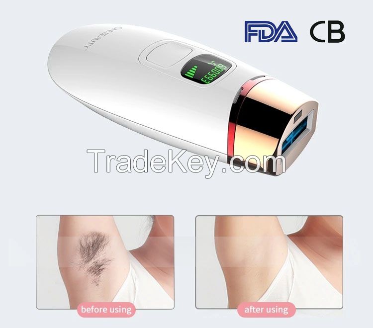 CB portable IPL hair removal device