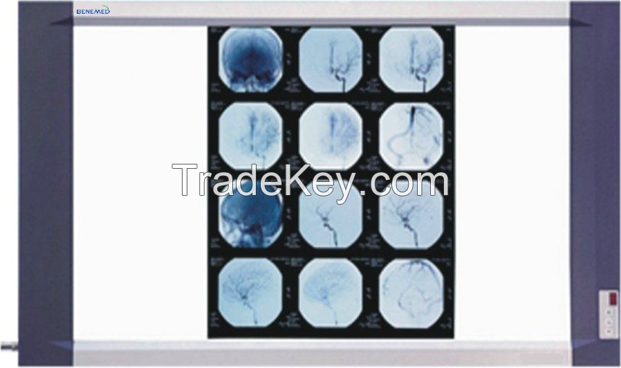 Ultraslim LED X-ray film viewer BV series