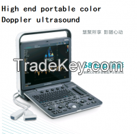 High end portable color Doppler ultrasound