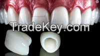Titanium Ceramic Crown False Teeth Ceramic Teeth