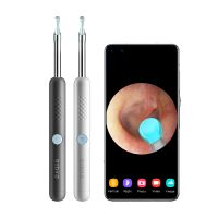 Ear Wax Removal Endoscope Otoscope, Earwax Remover Tools, Scope, with 1080P FHD Camera, 6 Led Lights, Wireless Connected, Compatible with iPhone, iPad, Android Smart Phones & Tablets