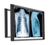 Sell x-ray film viewer