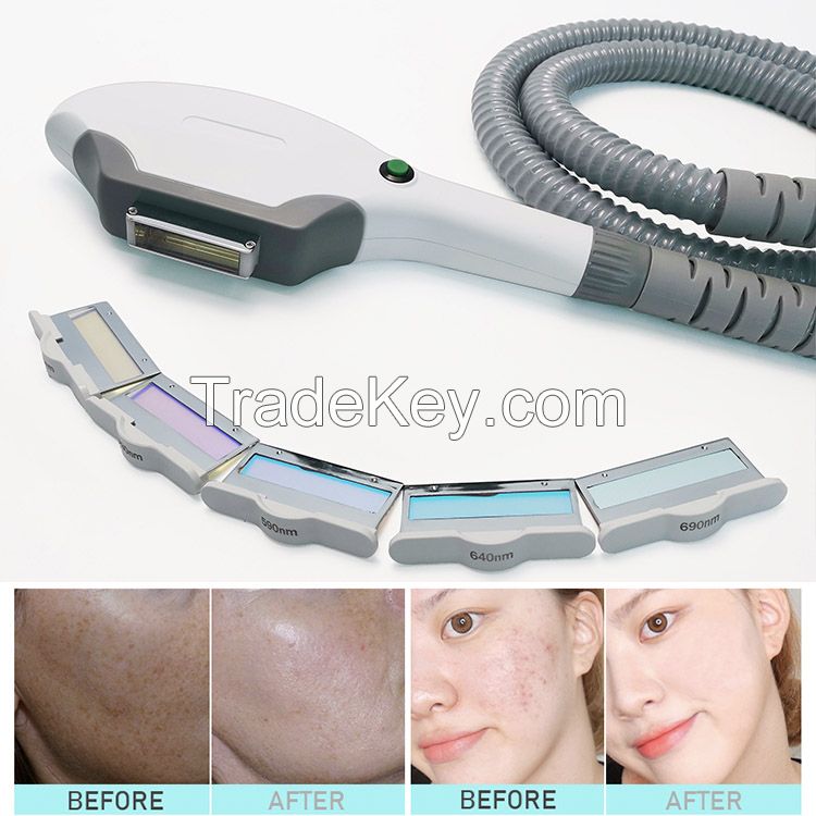 Multi-function diode laser hair removal / IPL skin rejuvenation