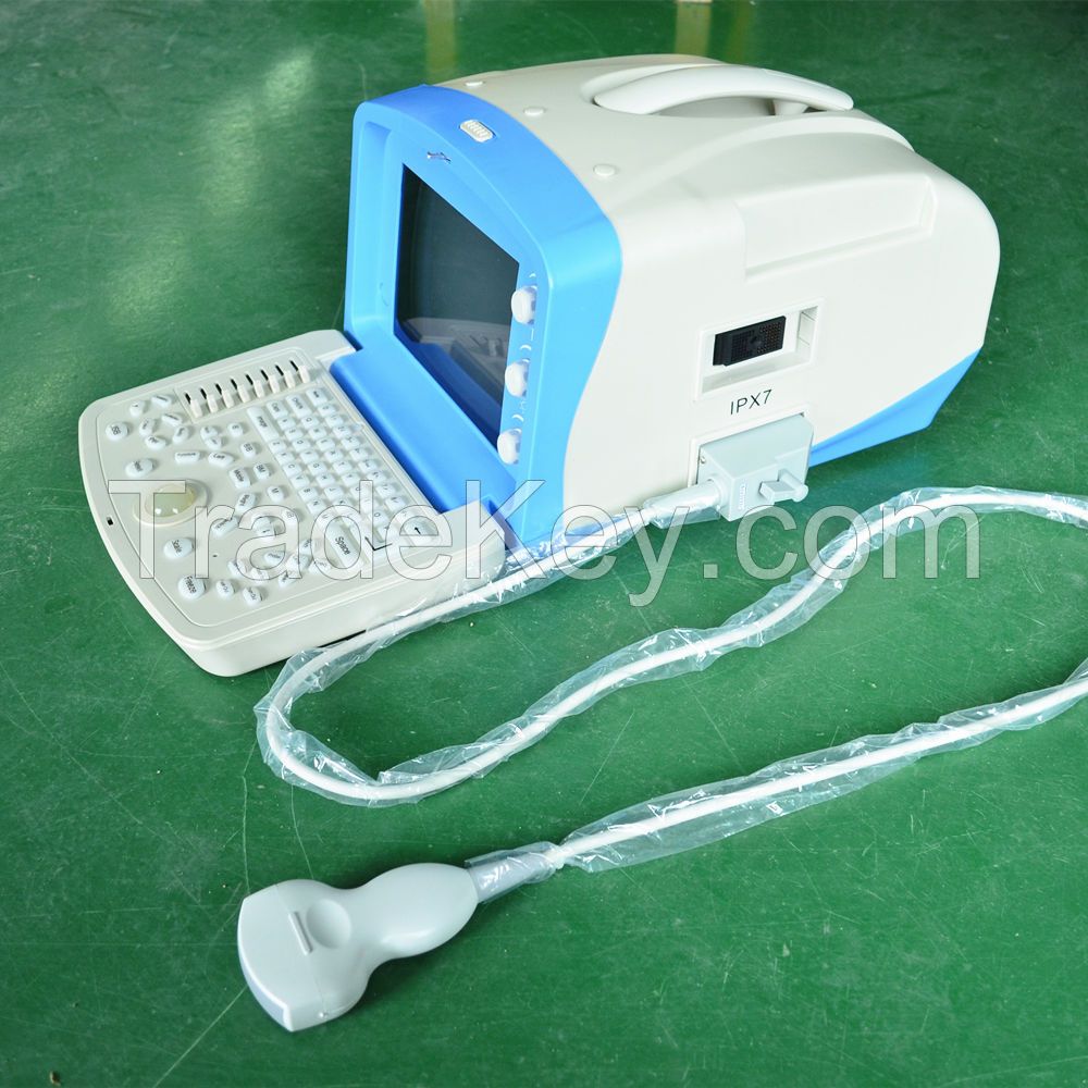 Human Use Digital Portable Ultrasound Scanner ATNL51353A