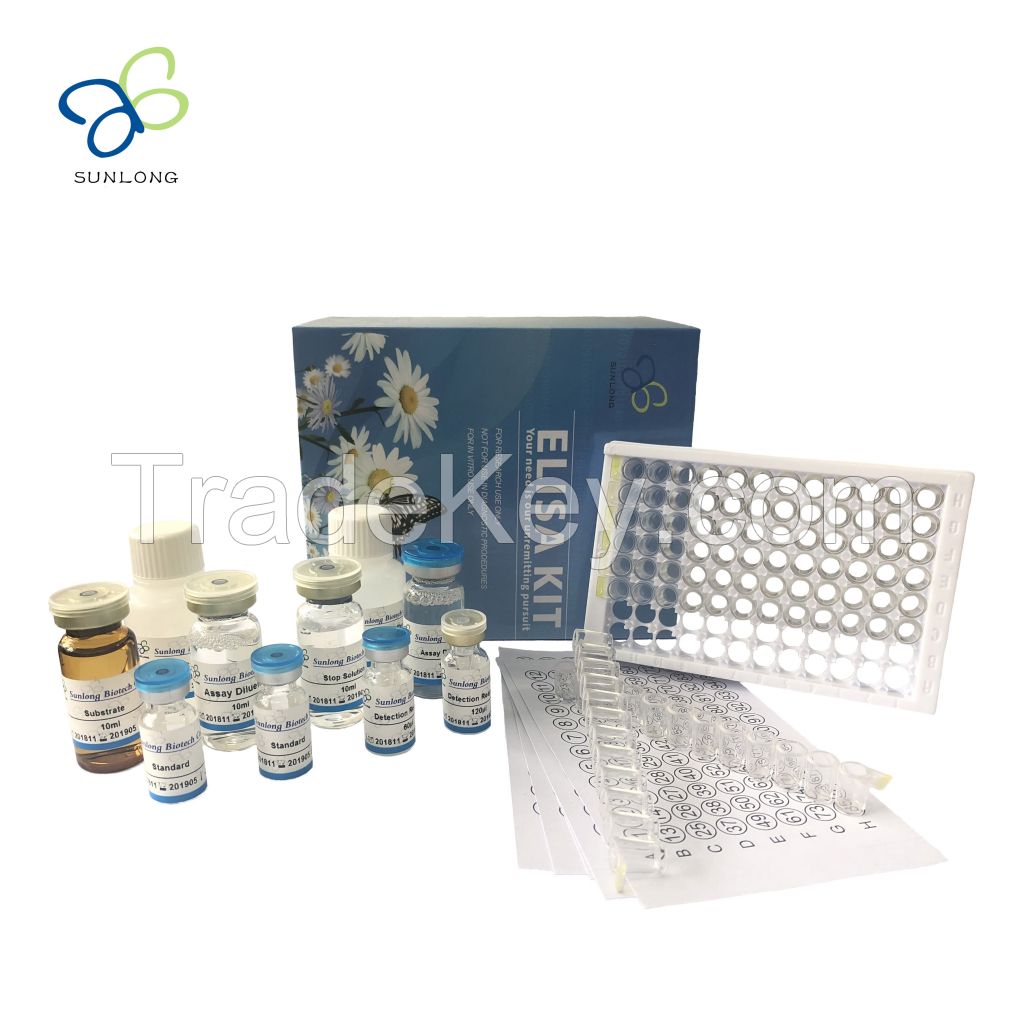 Human Matrix metalloproteinase-14,MMP14 Elisa Kit (E1610Hu)