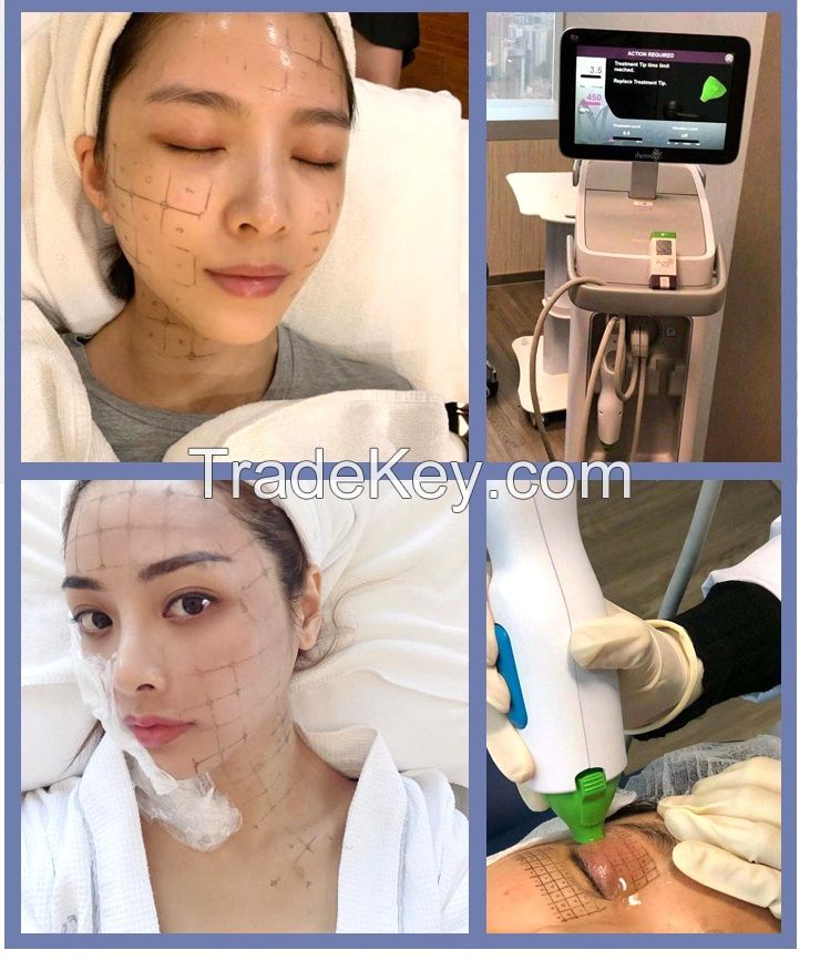 6.78MHz Radio Frequency Thermagic RF Wrinkle Remove Queen La Reina Thermacool Beauty System