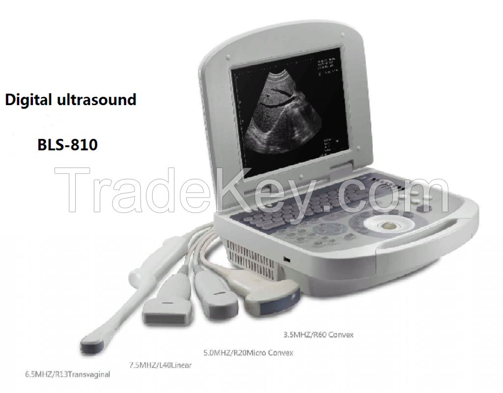 All digital ultrasonic diagnosis system