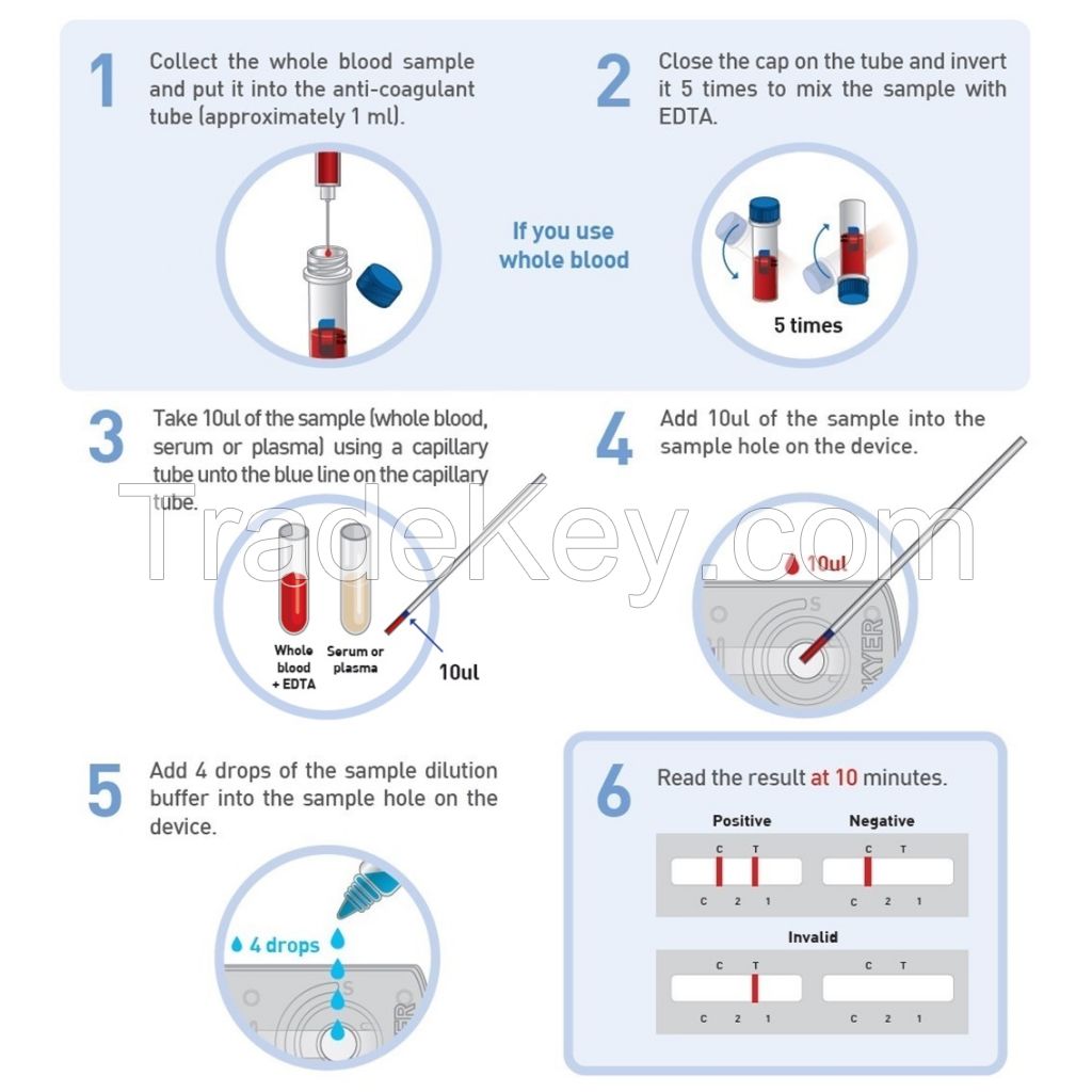 RIDX Leishmania Ab Rapid Test Kit