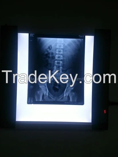 Ultraslim LED X-ray Film Viewer Single Section BV-360