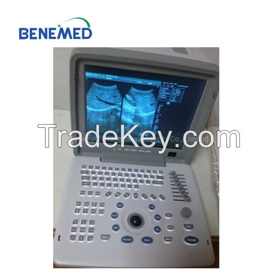 Portable B/W Ultrasound Scanner with Clear Image Quality