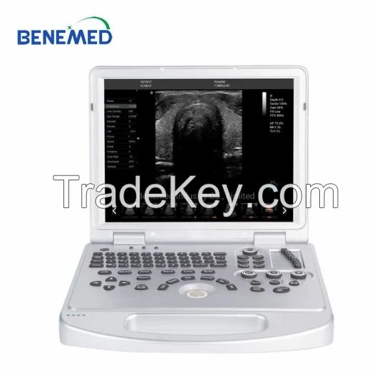 Laptop Notebook Ultrasound Scanner Color Doppler 3D 4D