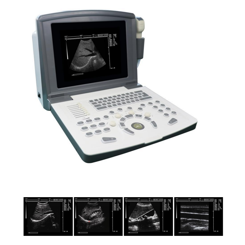 High quality BW ultrasound best cost-effective ultrasound for human good ultrasound for vet