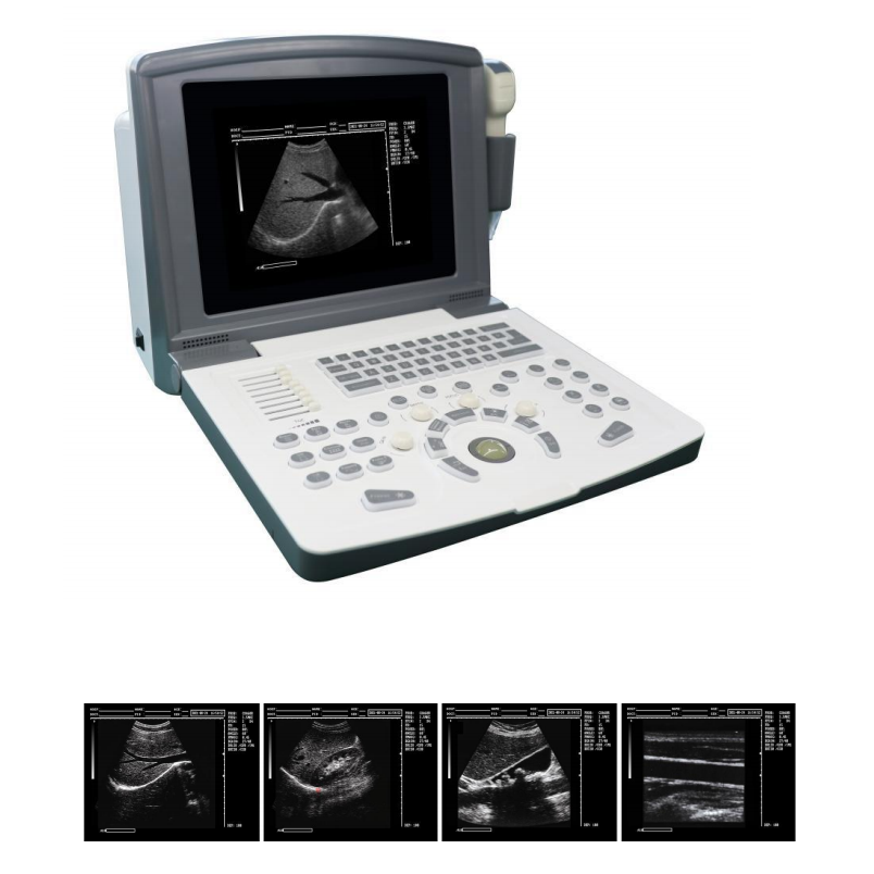 High Quality Bw Ultrasound Best Cost-effective Ultrasound For Human Good Ultrasound For Vet