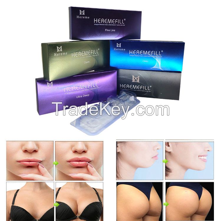 Ultra Deep Hyaluronic Acid Dermal Filler Augments Buttocks Filling Chest and Penis