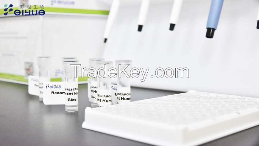 Human IL-20(Interleukin 20) ELISA Kit