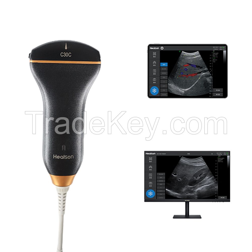 Healson C30C Pocket Handheld High Resolution Color Doppler Ultrasound