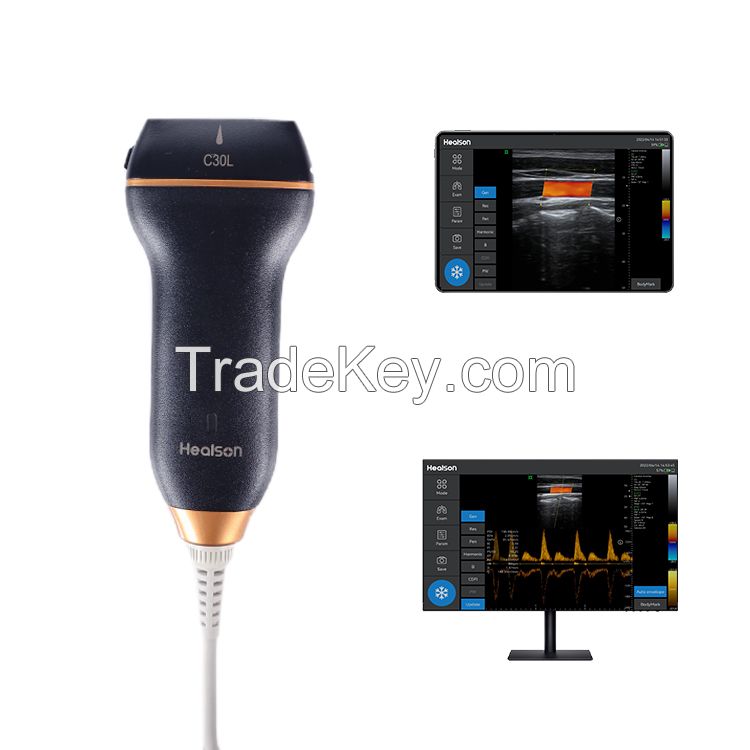 Healson Color Doppler Mini Handheld USB Linear Probe Portable Ultrasou
