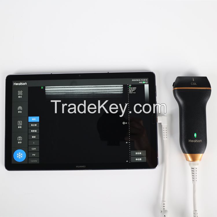 Healson Color Doppler Mini Handheld USB Linear Probe Portable Ultrasou