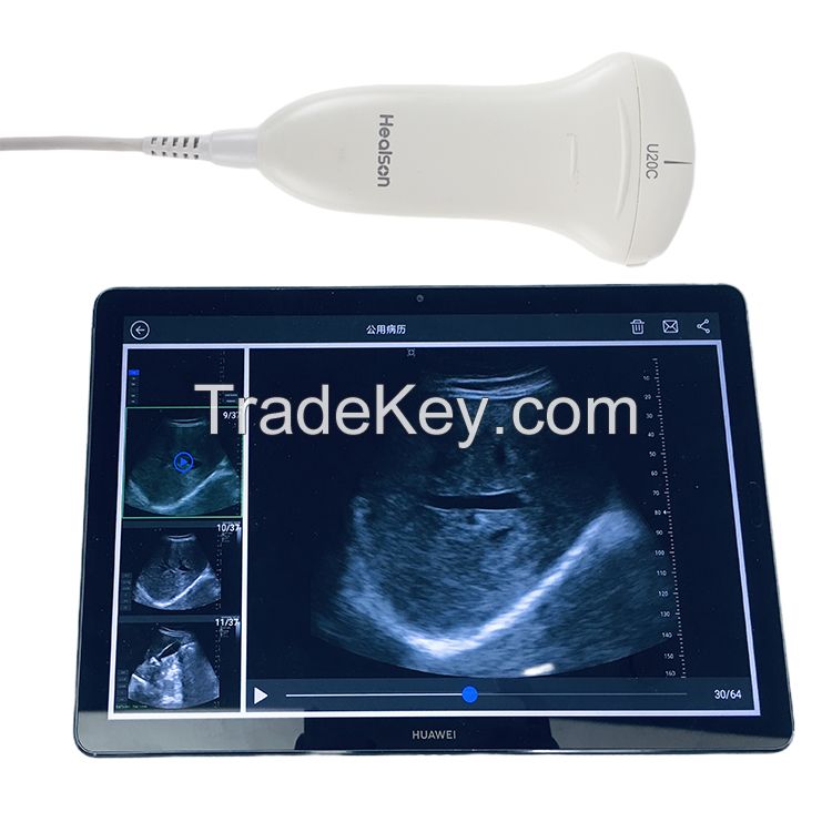 Pocket Ultrasound Mini Handheld Portable Sonography Machine Probe