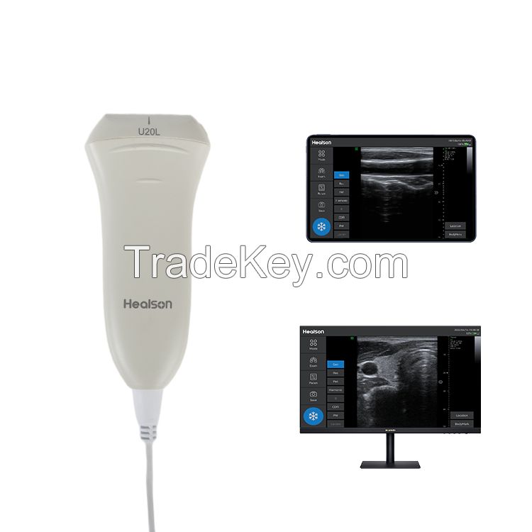 Handheld Linear Probe Machine Diagnostic Doppler Ultrasound Scanner