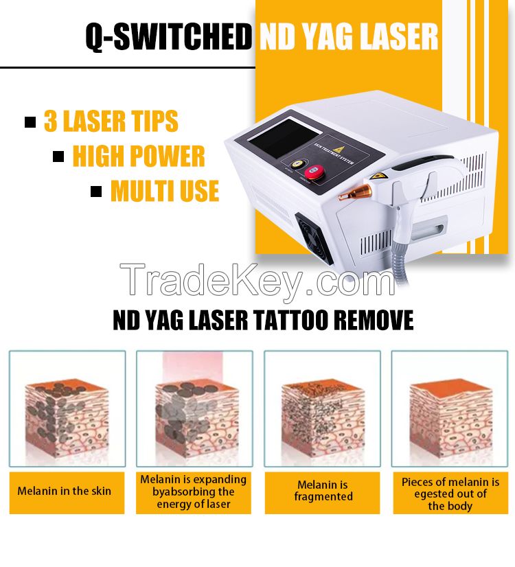 Q-SWITCHED ND YAG LASER