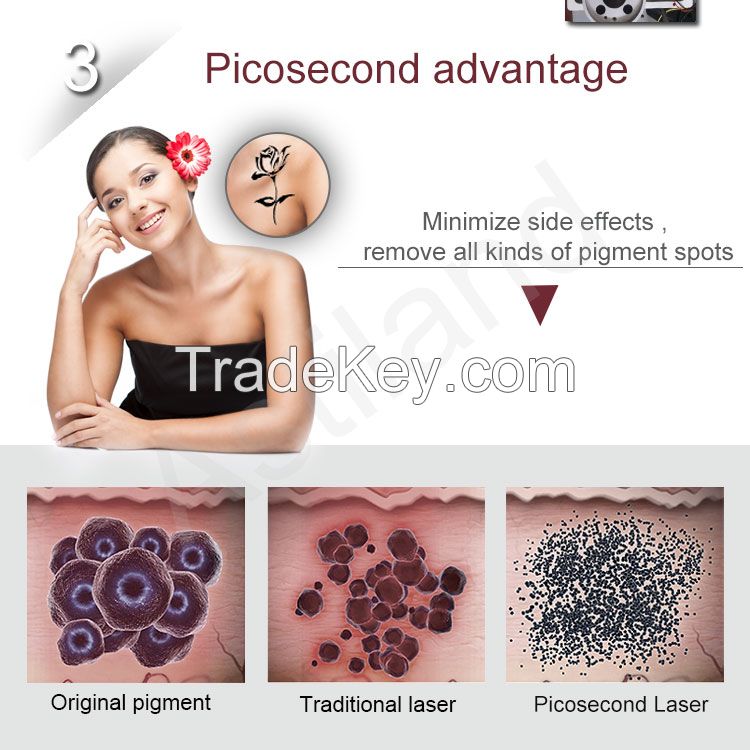 Picosecond Laser System