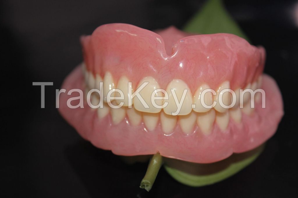 Dental Partial Denture, Titanium Denture, Dental Prothesis, Laboratoire Dentaire, Dentallabor, Dental