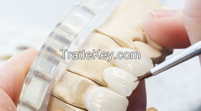 Emax Crowns - China Dental Lab Dental Crowns in Good Quality and Good Esthetics