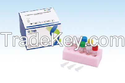 Group B Streptococcus Nucleic Acid Detection Kit (Fluorescent PCR)