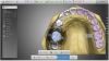 3D Orthodontic Software