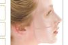 Hydrogel mask
