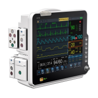 Hospital Portable Electronic Large Modular Vital Signs 17 Inch Lcd Multiparameter Patient Monitor  iHT9