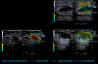4d Color Doppler Ultrasound Scanner