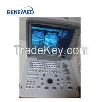 Portable B/w Ultrasound Scanner With Clear Image Quality