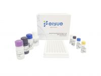 Human anti-immunodeficiency virus antibody,HIV ELISA Kit