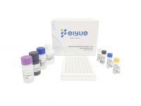 Human Anti-immunodeficiency Virus Antibody,hiv Elisa Kit