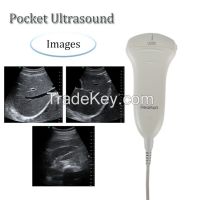 Pocket Ultrasound Mini Handheld Portable Sonography Machine Probe