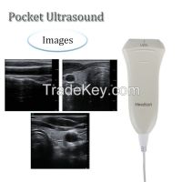 Handheld Linear Probe Machine Diagnostic doppler ultrasound scanner