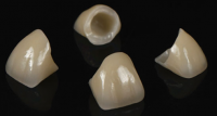 USA Dental Lab Outsourcing Service